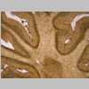 Microglia NDPasa 01.jpg